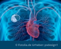 Sicherheitshinweis zu Herzschrittmachern des Herstellers Medtronic
