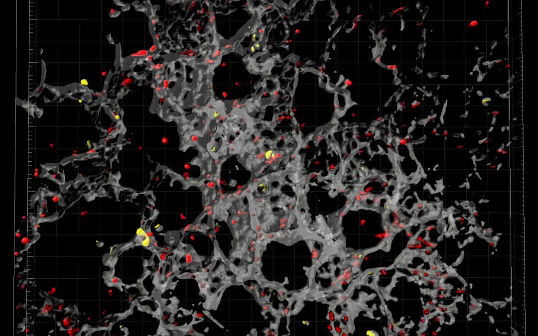 Vorgänge bei Lungenentzündung: WWW-Forscher liefern neue Erkenntnisse zur Interaktion von Blutplättchen und weißen Blutkörperchen