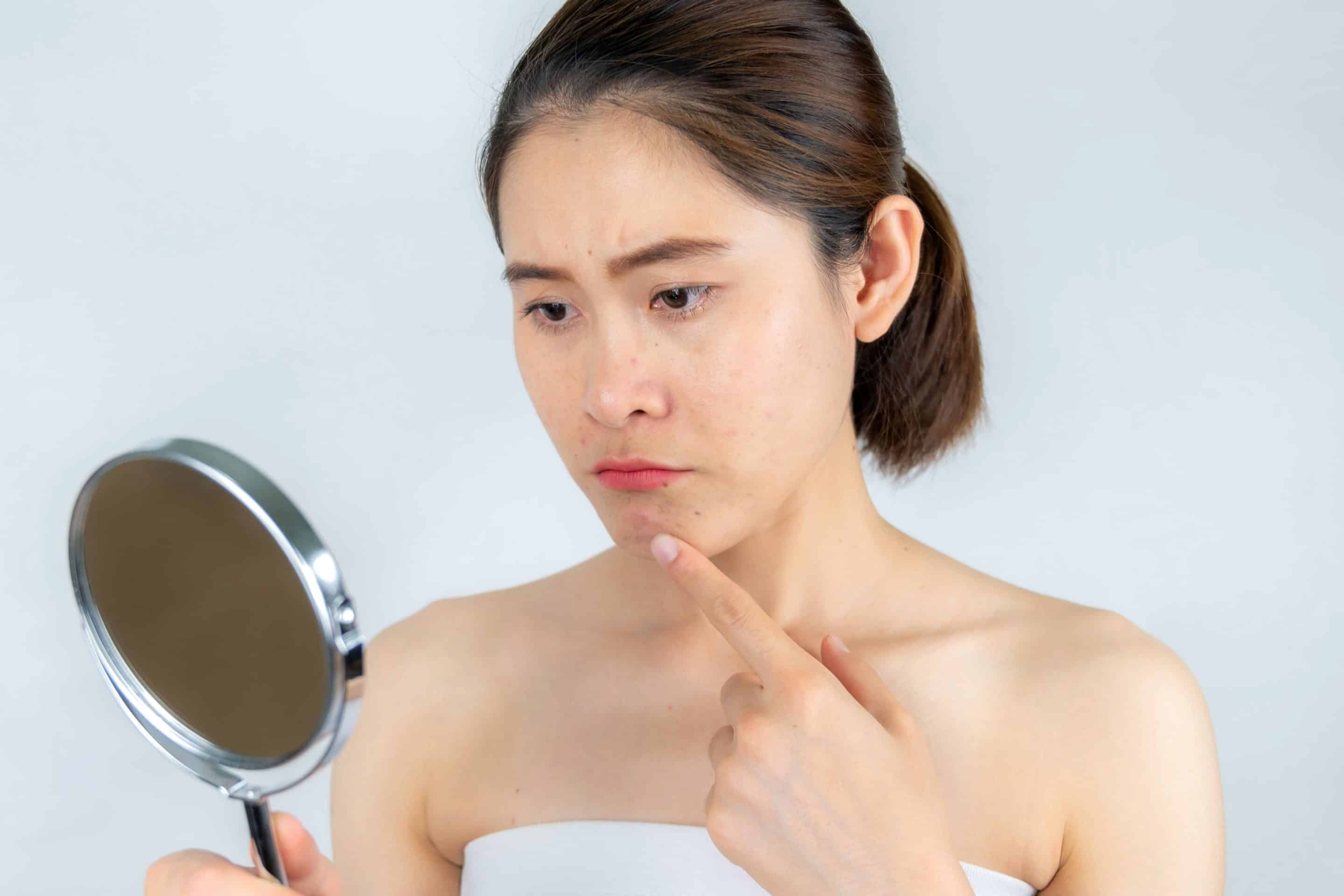 Hautentzündungen: Nicht quetschen, sondern gezielt behandeln: Eitrige Hautentzündungen sollten sanft aufgelöst werden. Foto: djd/ilon Salbe classic/Getty Images/Boyloso