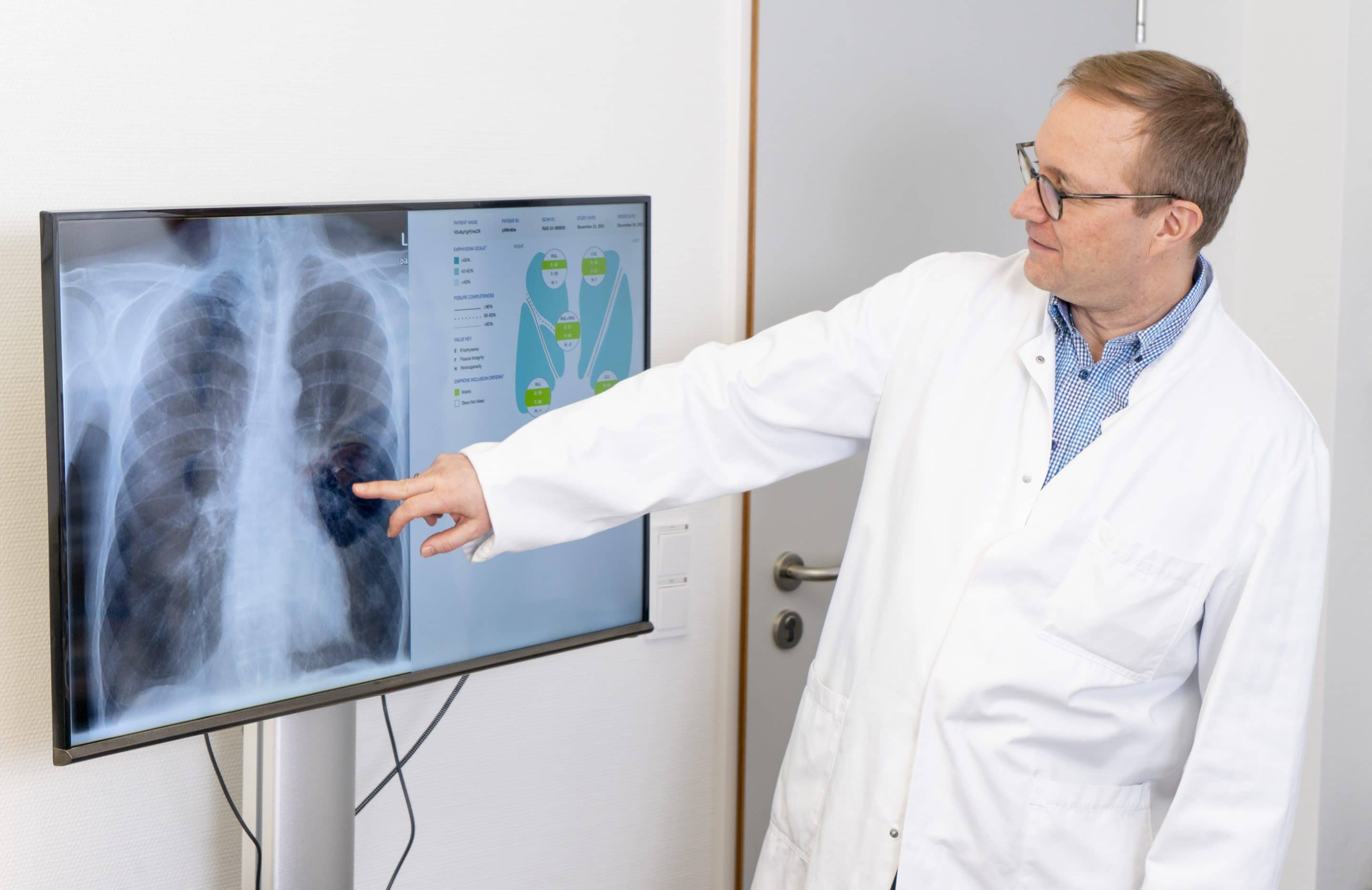 COPD: Dr. Andreas Gröschel ist Chefarzt der Klinik für Innere Medizin II – Pneumologie des Clemenshospitals.